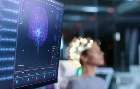 Brain imaging software on a computer monitor