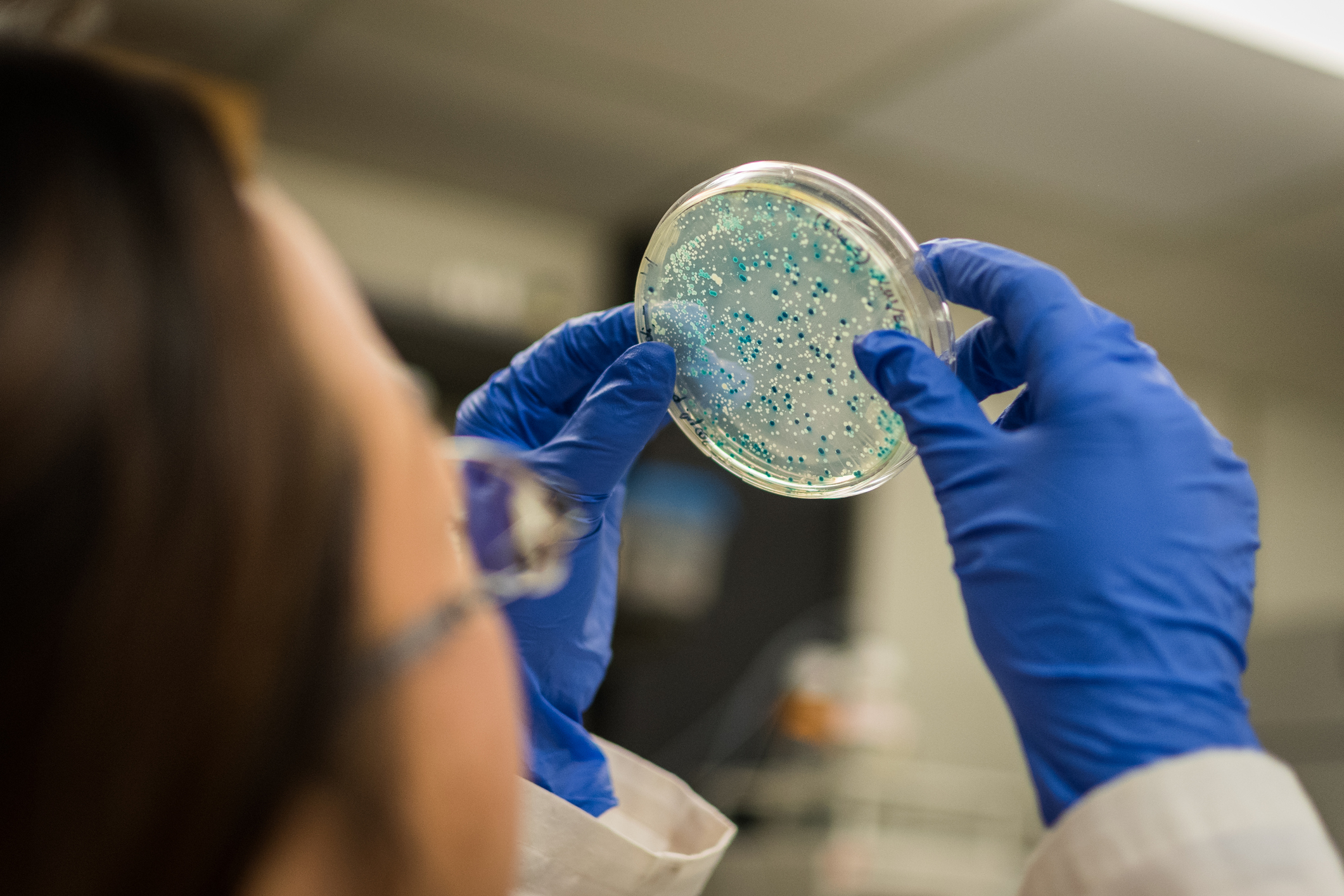 A researcher examining a bacterial culture